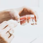 crowns implants teeth